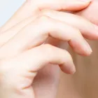 顎関節症